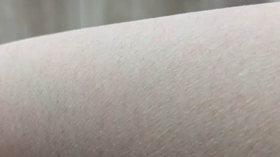 薄い毛には効果が出にくい