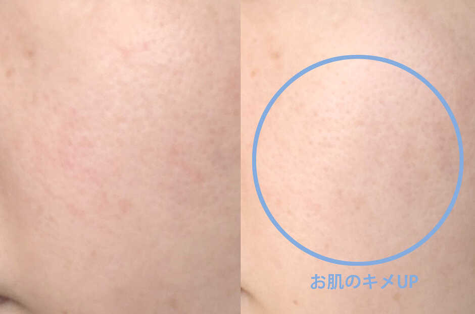 肌ゆらぎが2〜3日で“スッと”落ち着いた