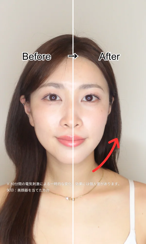 ビフォーアフター２