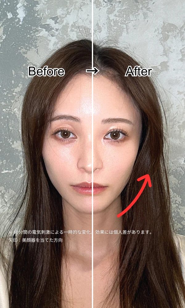 ビフォーアフター１