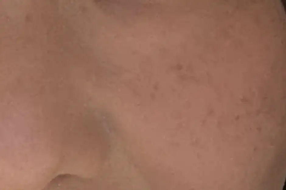 2年前の私、画像を見ての通りメイク後ですらかなり汚い肌