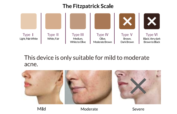 フィッツパトリックスケールで肌タイプをチェック
