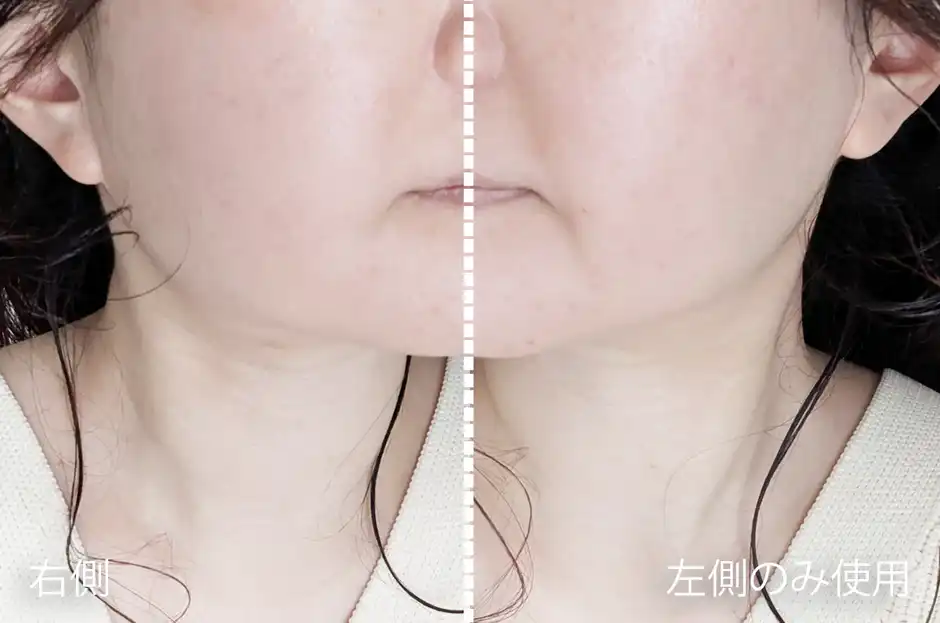 左側だけに『ZIIP HALO 2.0』を使ってみた比較写真