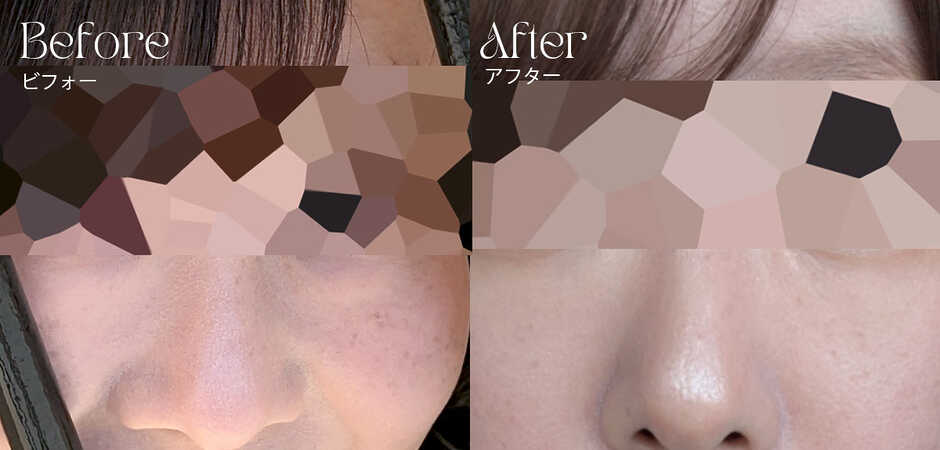 2年以上使ってみたビフォーアフター