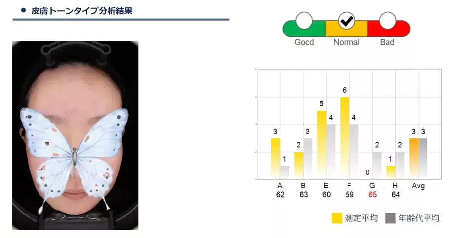 ネオヴォワール肌診断の皮膚トーンタイプの結果(平均3・Normal判定)