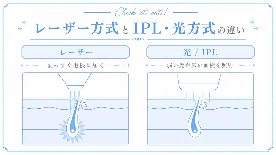 【買う前に絶対確認】IPL・光方式とレーザー方式の違い：図解