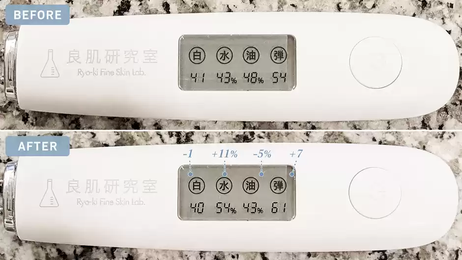 効果をスキンチェッカーで数値化してみた【-1／+11／-5／+7】