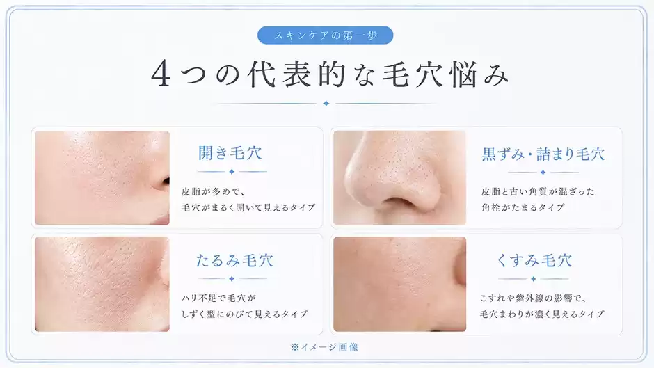 あなたの毛穴はどのタイプ？【4タイプ診断】