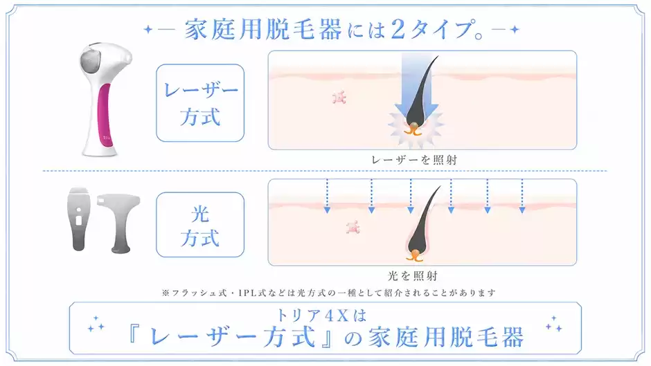 家庭用脱毛器には光方式とレーザー方式の2タイプがある