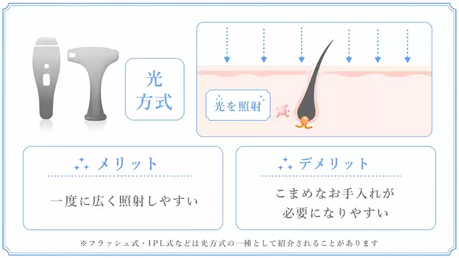 光方式(IPL・フラッシュ)が"パワー弱い"と感じやすい仕組み