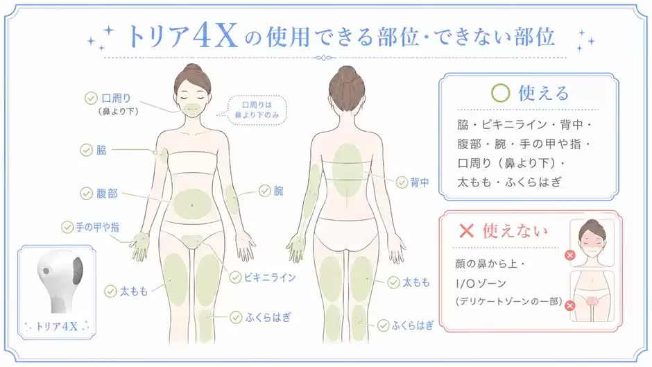 【使える部位】パワーが強い家庭用脱毛器トリア4Xで脱毛できる場所・NGな場所