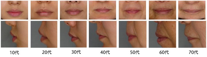 花王の研究では、口もとの形状変化の多くが40代ごろから見られる