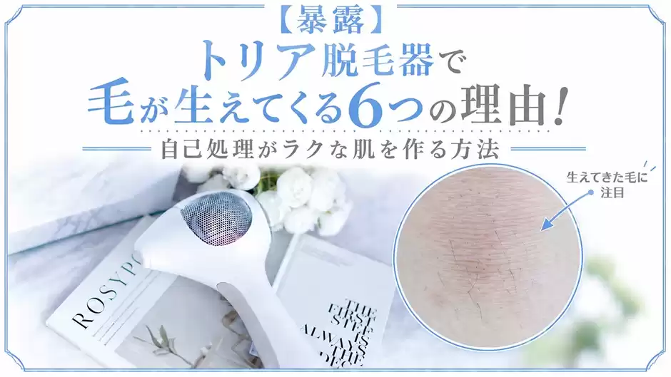 【暴露】トリア脱毛器で毛が生えてくる6つの理由！自己処理がラクな肌を作る方法