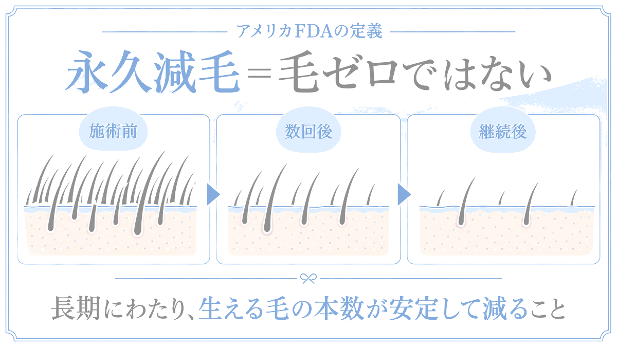 永久脱毛の定義、じつはアメリカFDAでは「永久減毛」